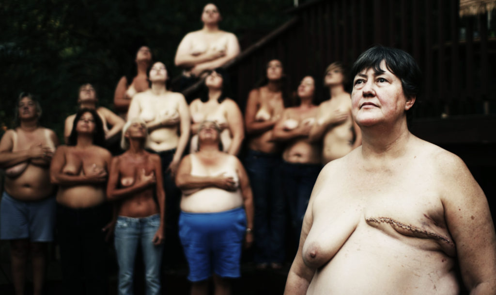 Breast cancer survivors