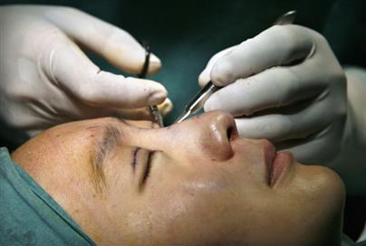 Up to 80% of plastic surgery procedures conducted last summer was on students. Image from watchmojo.com