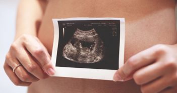 Pregnant ultrasound photo