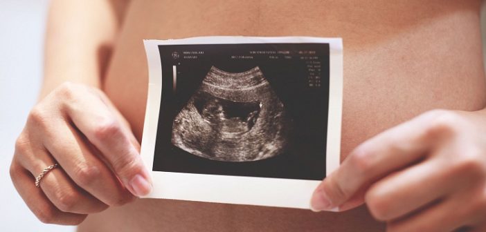 Pregnant ultrasound photo