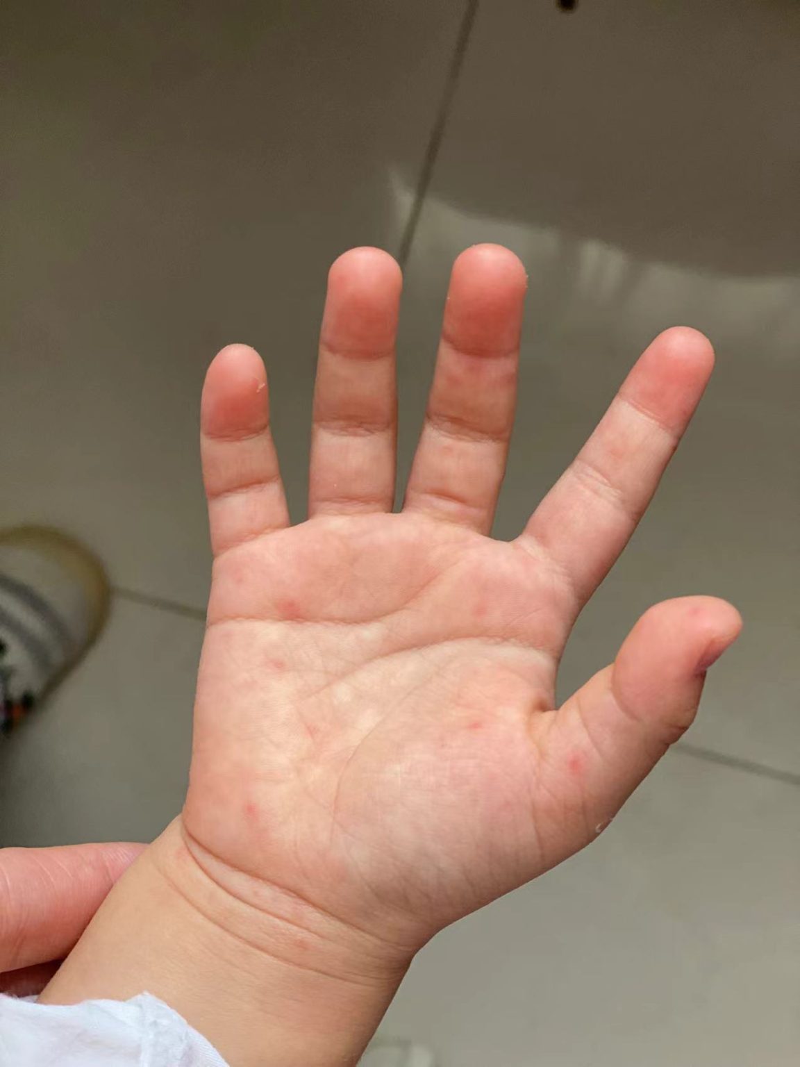 The Basics on Hand, Foot, and Mouth Disease jingkids international